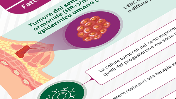 Infografica Tumore del seno