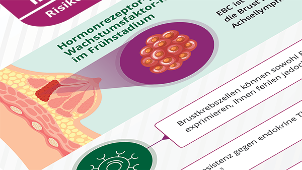 Infografik Brustkrebs