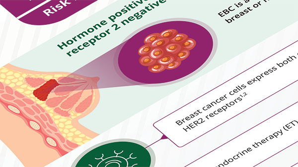 Infographic Breast Cancer