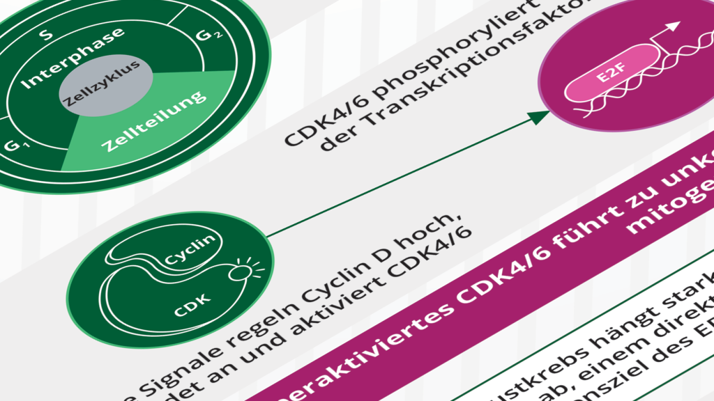 Infografik - Mechanismen und neue therapeutische Kombinationen